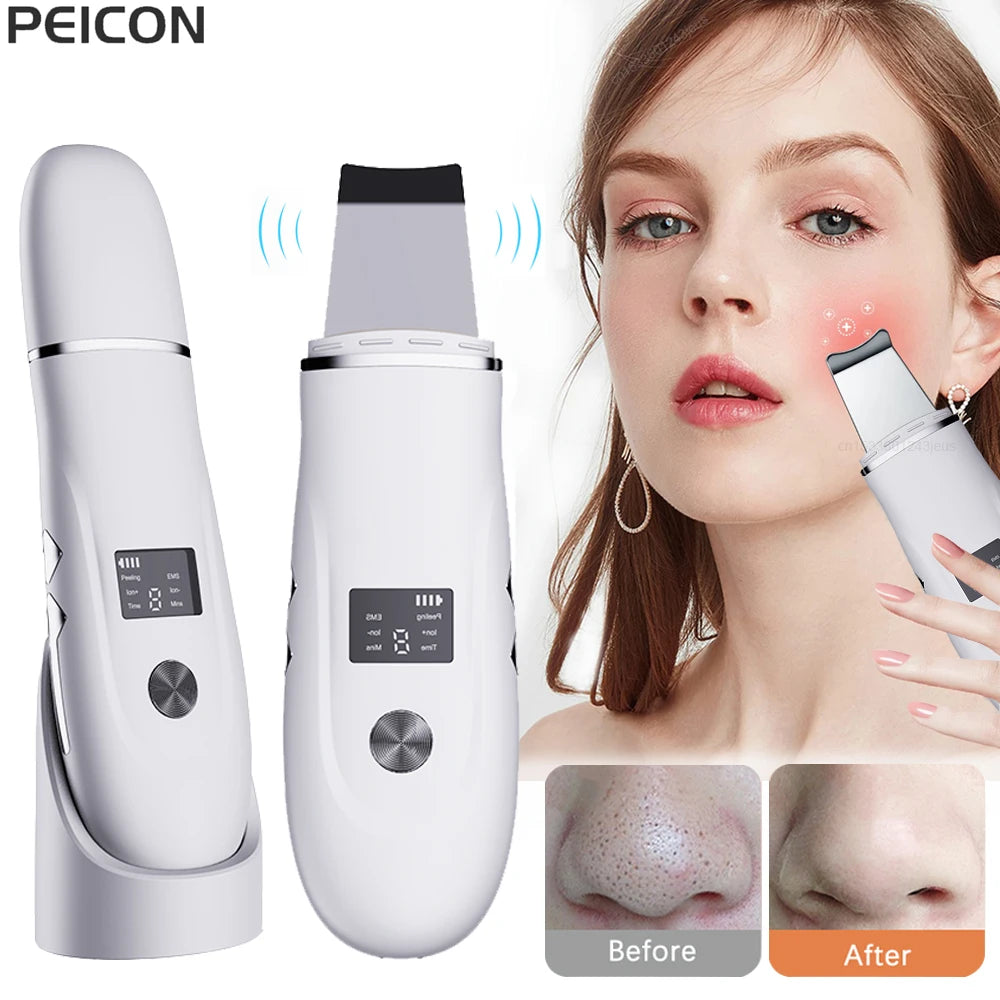 Ultrasonic Face Scrubber single